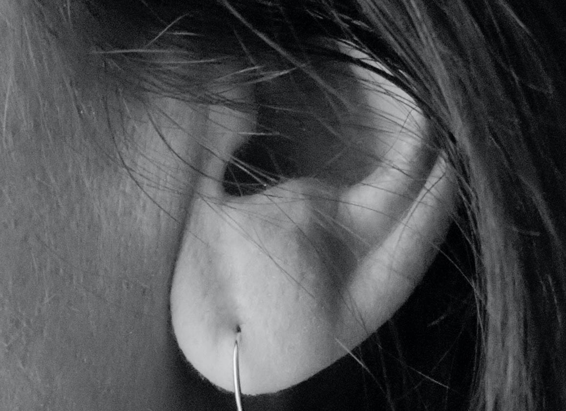 Tinnitus Retraining Therapy